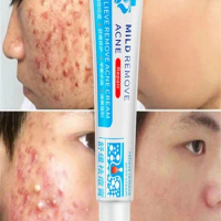 Salicylic Acid Acne Treatment Cream Repair Pimple Spots Shrinking Anti-acne Deep Cleaning Pore Oil Control Moisturizer Skin Care