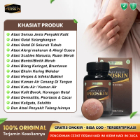 Proskin Kapsul Original 100% Terlaris - Obat Gatal Kulit Proskin - Obat Herbal Multikhasiat Khusus P