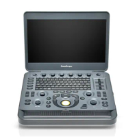 SonoScape X5 Laptop Styled Impressive High Definition Digital Laptop Color Doppler Veterinary Laptop Ultrasound Instrument