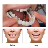 Sdatter Perfect Fit Teeth Whitening Fake Tooth Cover Adjustable Snap On Smile Veneers Temporary Resin False Braces Dental Prosth