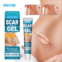 ERAYCEE Hot selling, thin scar gel, thin scar, scald abdominal skin care