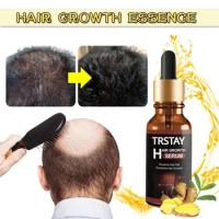Fast Hair Growth Ginger Oil Natural Plant Essence Faster Grow Hair Tonic Growing Shampoo No Hair Loss Hair Care Beauty Tools
