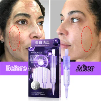 Freckles Whitening Serum Remove Dark Spot Brighten Skin Essence Anti-Aging Fade Pigment Melasma Melanin Face Care Beauty Health