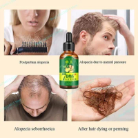 Sdottor Ginger Hair Growth Spray Strengthening-Hair Massage Scalp Dense-Hair Strengthening Hair Loss Prevention Repair Nourishin
