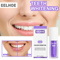 Sdatter Teeth Toothpaste Brightening Preventing Periodontitis Removal Bad Breath Dental Cleansing Care