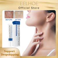 EELHOE Firming Neck Cream Skin Care Anti Wrinkle Tightening Anti Aging Nouish Neck Lightening Cream Whitening Skin Rejuvenation