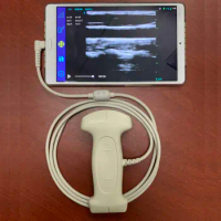 Convex-Linear in One Ultrasound Probe with USB/Type C Connector for Android Mobile Phone and Computer