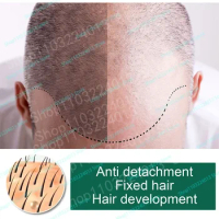 Sdottor Hair Growth Spray Natural Healthy Hair Grow Essential oil Treatment Preventing Hair Loss Spray hair-restorer