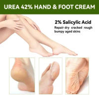 Sdottor New Urea Cream Dry Cracked Feet Heels Hands Body Repair Exfoliating peeling Treatment Moisturizing Callus Dead Skin Remo