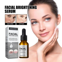 Facial Brighten Essence oil Whitening Correcting Dark Spot Removal Melasma Melanin Skin Fade Pigment Freckle Moisturizing Serum