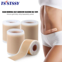 1 Roll Efficient Beauty Self-Adhesive Silicone Gel Tape Removal Scar Tape Therapy Patch for Acne Trauma Burn Scar Skin Repair