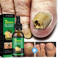 7 Days Nail Fungal Treatment Essence Oil Foot Toe Nail Fungus Removal Serum Onychomycosis Anti Infection Gel Beauty Health Care