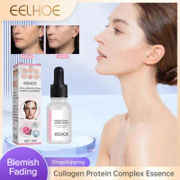Acne Removal Face Serum Collagen Protein Pore Shrinking Pimples Dark Spots Removal Fade Pigment Improve Lines Blemish Essence