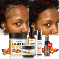 Fast Hair Growth Oil Africa Crazy Traction Alopecia batana Hair Mask Anti Hair Break Hair Strengthener Hair Loss Treatment Spray