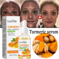 Turmeric Whitening Freckle Serum Bright Face Skin Corrector Fade Dark Spot Curcumin Oil Removal Pigment Lighten Melanin Beauty