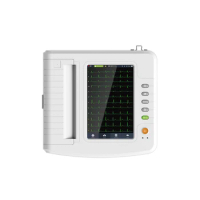 CONTEC E1218G portable touch screen electrocardiograma ecg machine hospital ecg