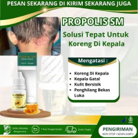Propolis SM - Untuk Salep Cair Untuk Koreng Di Kepala, Gatal Kulit Kepala, Tetes Ketombe Parah
