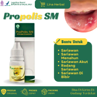 Propolis SM Atasi Sariawan, Sariawan Menahun, Sariawan Di Bibir, Sariawan Akut, Radang Sariawan, Sar