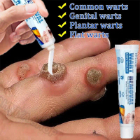 Salep Obat Kutil Paling Wart Removal Cream Penghilang Tahi Lalat Krim Penghilang Lalat Krim Penghila