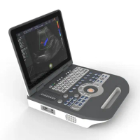 S3800 Notebook Color Doppler Ultrasound Scanner 15.5 Inch Portable Laptop Medical Ultrasound Device Ultrasound Machine Scanner