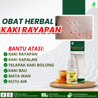 Propolis SM Obat Kaki Rayapan, Kaki Kapalan, Telapak Kaki Bolong Bolong, Telapak Kaki Pecah Pecah, T