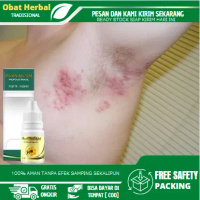 Salep Untuk Iritasi Ketiak, Ketiak Ruam, Dermatitis, Alergi Deodoran, Gatal Merah Pada Ketiak, Lipat