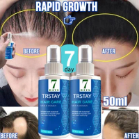 Hair Growth Spray Ginger Hair Grow Hair essential oil Treatment Preventing Hair Loss Spray hair-restorer