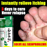 Herbal Athlete's Foot Ointment | Anti-Itching, Exfoliating, Antibacterial & Deodorant | Foot Care Ub