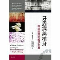 牙周病與植牙 臨床問題的解決方案  Hughes 2017 台灣愛思唯爾有限公司
