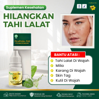 Propolis SM Original - Penghilang Tahi Lalat Di Wajah, Milia, Karang Di Wajah, Skin Tag, Kutil Di Wa