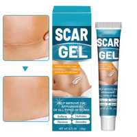 Scar Removal Cream Stretch Marks Repair Burn Skin Treat Keloids Remove Gel Whitening Smooth Skin Care