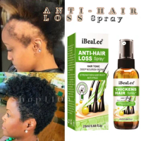 Anti Hair Loss Spray Volumizing &amp; Strengthening Root Hair Growth Spray 20m Regeneration Spray For Women &amp; Men