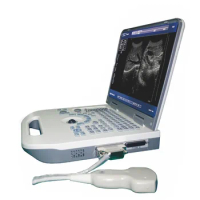 MY-A008C Notebook Ultrasound Scanner Portable screen ultrasound instruments machine digital ultrasouns
