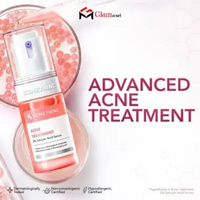 GLAM - SOMETHINC Acne Treatment 2% Salicylic Acid Serum - Serum Usir Jerawat Mendem