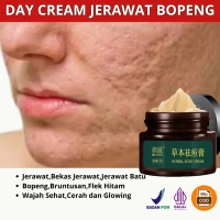 Ampuh Cream Penghilang Jerawat penghilang bekas jerawat bopeng bekas jerawat pria dan wanita menghil