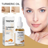 Turmeric Melasma Whitening Correcting Serum Facial Care Essence Oil Dark Removal Brighten Skin Fade Pigment Freckle Melanin