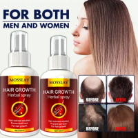 Hair Growth Serum Spray Fast Growth Liquid Treatment Scalp Hair Follicle Anti Loss Natural Beauty Health Hair Care
