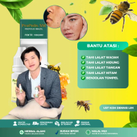 Cairan Tetes Propolis SM - Perawatan Untuk Tahi Lalat Hidup Papiloma Skin Tag Daging Tumbuh Keloid K