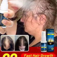 Hair Growth Products for Men Women Hair Loss Treatment Fast Grow Hair Spray Regrowth Thicken Oil Hair Care