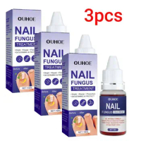 3PCS Nail Fungal Treatment Feet Care Essence Anti Infection Paronychia Onychomycosis Nail Repair Toe Fungus Serum Fungal Removal