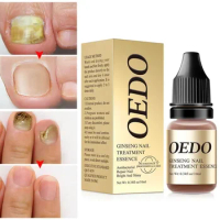 Fungal Nail Treatment Oil Foot Repair Essence Toe Nail Fungus Removal Gel Anti Infection Cream Fungal Nail Removal