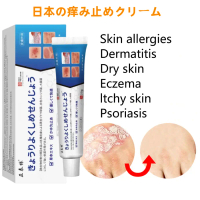 Salep gatal Salep Eksim Salep kulit Krim psoriasis paling ampuh Kulit Kepala Psoriasis Tangan Tinea 