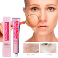 Fade Melasma Whitening Serum Facial Care Essence Oil Dark Spot Removal melanin repair Brighten Skin Pigment Freckle Essence