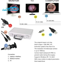Direct connect to PC/TV for ENT diagnosis portable USB endoscope camera