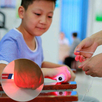 Vein Finder Alat Pencari Vena Alat bantu pasang infus