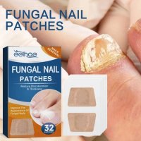 Nail Repair Patch Grey Fungal Nails Thickening Soft Paronychia Treatment Ingrown Toenail Care Anti Infection Correction Sticker
