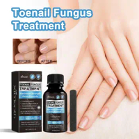 Natural Nail Care Treatment Natural Extra Strength Nail Fungus Treatment Solution for Healthy Toenail Fingernails for Nails