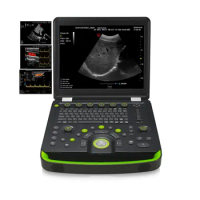 medical Color Doppler Adult heart Carotid artery portable Vascular Cardiac Ultrasound machine laptop with battery &amp; travel case