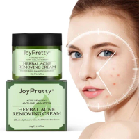 50g Acne Face Cream Pimple Scar Removal Shrink Pore Oil Control Moisturizing Facial Cream Acne Treatment Skin Care Cream
