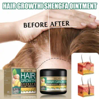 2023 New Eelhoe Hair Growth Cream Beauty Health Oil For Hair Moroccan Germination Cream Hair Repair Cream Fast Hair Growth Cream